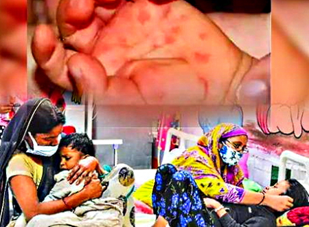 Fiebre del tomate en India: qué es, qué síntomas tiene, cómo se transmite y a quién afecta